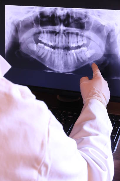 Best Emergency Dental Extractions in Newburyport, MA